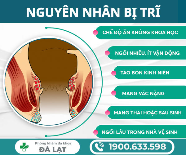 Hình ảnh minh họa